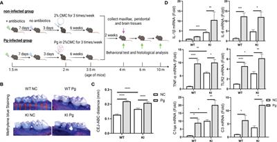 Periodontal Infection Aggravates C1q-Mediated Microglial Activation and Synapse Pruning in Alzheimer’s Mice